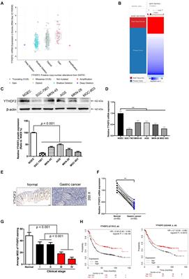 YTHDF2 Inhibits Gastric Cancer Cell Growth by Regulating FOXC2 Signaling Pathway